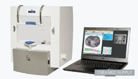 Metrovision Visual Field Analyzer MonPackONE-visual-field